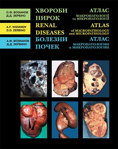 Хвороби нирок. Атлас макропатології та мікропатології