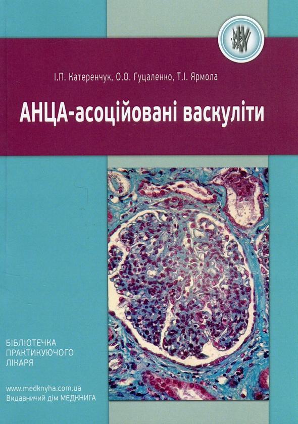 АНЦА-асоційовані васкуліти