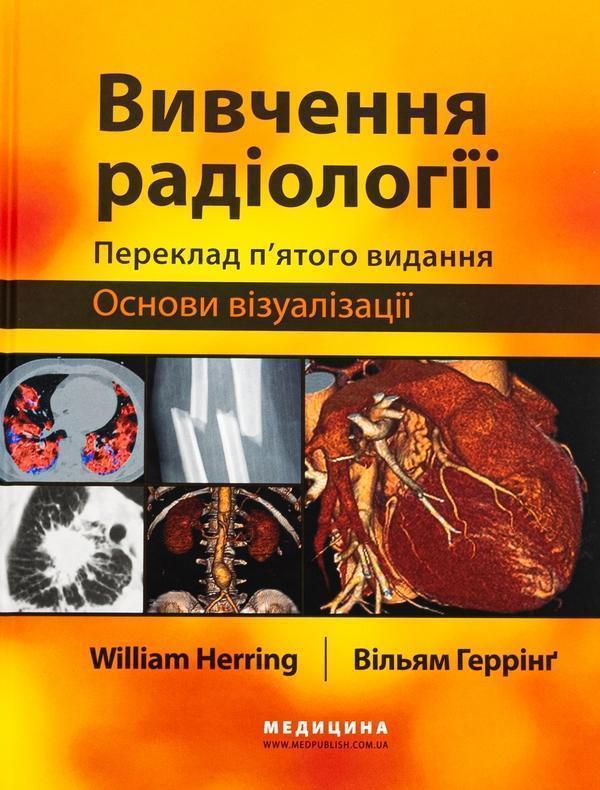 Вивчення радіології. Основи візуалізації