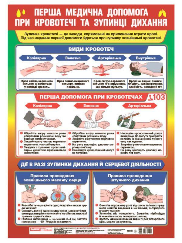 Перша медична допомога при кровотечі та зупинці дихання....