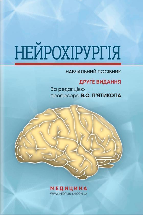 Нейрохірургія